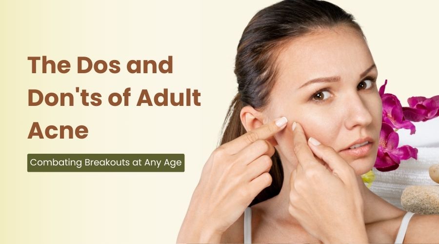 The Dos and Don'ts of Adult Acne: Combating Breakouts at Any Age