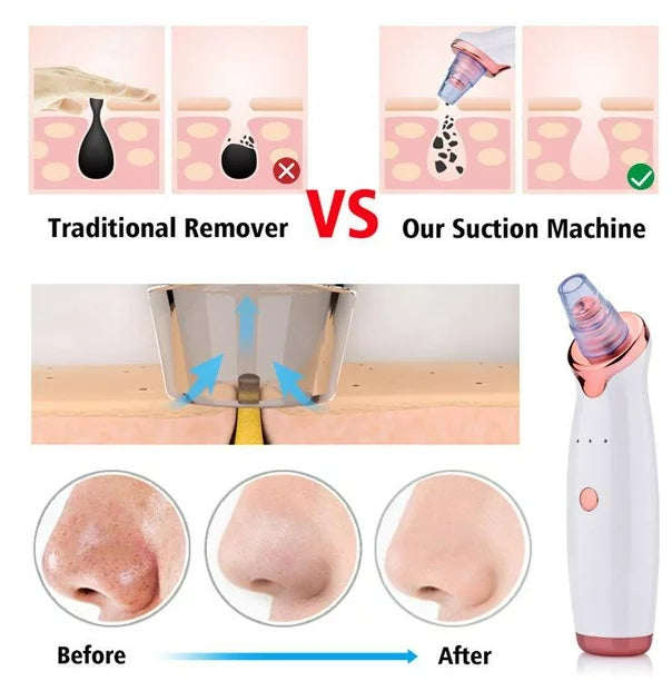 Buy Facial Beauty Electric Blackhead Remover Pore Vacuum Suction Dermabrasion Face Cleaner Machine in Pakistan